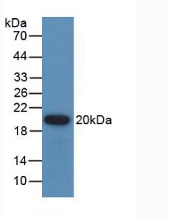 Polyclonal Antibody to Gremlin 1 (GREM1)