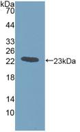 Polyclonal Antibody to Gremlin 1 (GREM1)