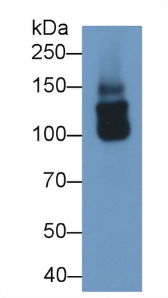Polyclonal Antibody to Collagen Type XVIII (COL18)