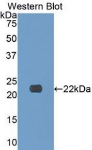 Polyclonal Antibody to Collagen Type XVII (COL17)