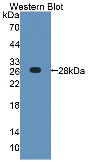 Polyclonal Antibody to Collagen Type IV Alpha 4 (COL4a4)