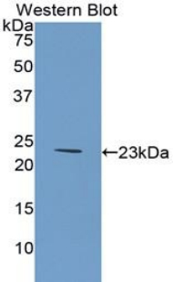 Polyclonal Antibody to Collagen Type VI Alpha 1 (COL6a1)