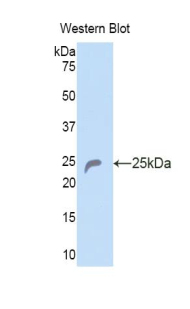 Polyclonal Antibody to Collagen Type VI Alpha 1 (COL6a1)