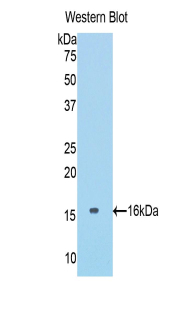 Polyclonal Antibody to Collagen Type VI Alpha 1 (COL6a1)