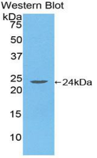 Polyclonal Antibody to HLA Class II Histocompatibility Antigen, DR Alpha Chain (HLA-DRA)