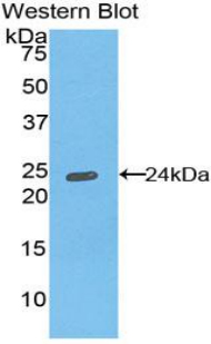 Polyclonal Antibody to HLA Class II Histocompatibility Antigen, DR Alpha Chain (HLA-DRA)