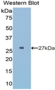 Polyclonal Antibody to HLA Class II Histocompatibility Antigen, DR Alpha Chain (HLA-DRA)