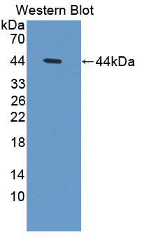 Polyclonal Antibody to Persephin (PSPN)