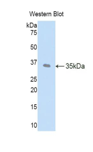 Polyclonal Antibody to Left/Right Determination Factor 1 (LEFTY1)