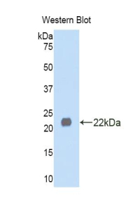 Polyclonal Antibody to Left/Right Determination Factor 1 (LEFTY1)