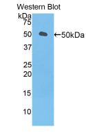 Polyclonal Antibody to Left/Right Determination Factor 1 (LEFTY1)