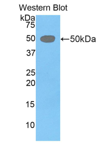 Polyclonal Antibody to Left/Right Determination Factor 1 (LEFTY1)