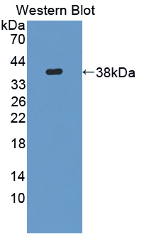 Polyclonal Antibody to Neurocan (NCAN)