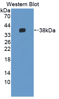 Polyclonal Antibody to Neurocan (NCAN)