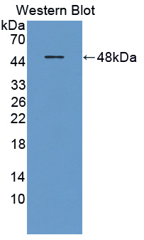 Polyclonal Antibody to Neurotrophic Tyrosine Kinase Receptor Type 3 (NTRK3)