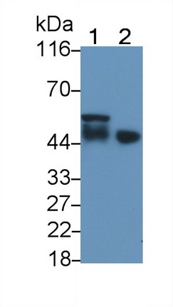 Polyclonal Antibody to Ciliary Neurotrophic Factor Receptor (CNTFR)