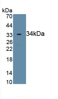 Polyclonal Antibody to Ciliary Neurotrophic Factor Receptor (CNTFR)