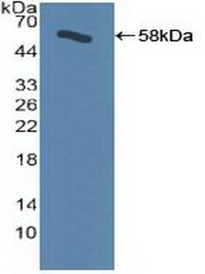 Polyclonal Antibody to Beta Adrenergic Receptor Kinase (BARK)