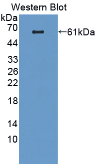 Polyclonal Antibody to Vav 1 Oncogene (VAV1)