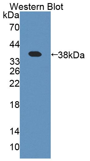 Polyclonal Antibody to Amyloid Beta Precursor Protein Binding Protein 1 (APPBP1)