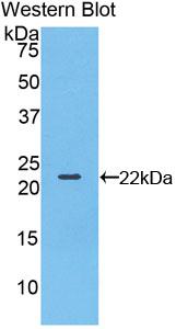 Polyclonal Antibody to Bleomycin Hydrolase (BLMH)