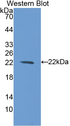 Polyclonal Antibody to Bleomycin Hydrolase (BLMH)