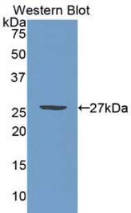 Polyclonal Antibody to Promyelocytic Leukemia Protein (PML)