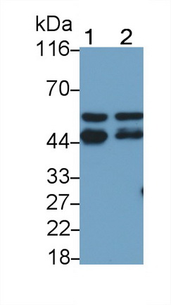 Polyclonal Antibody to Protein Tyrosine Phosphatase, Non Receptor Type 1 (PTPN1)