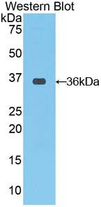 Polyclonal Antibody to C-Raf Proto Oncogene Serine/Threonine Protein Kinase (Raf-1)