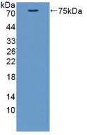 Polyclonal Antibody to Cortactin (CTTN)