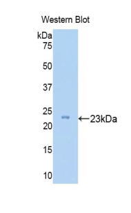 Polyclonal Antibody to Zyxin (ZYX)