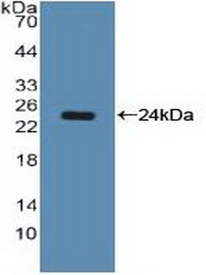 Polyclonal Antibody to Nucleolin (NCL)