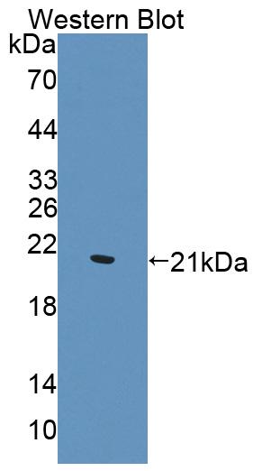 Polyclonal Antibody to Wilms Tumor 1 Associated Protein (WTAP)