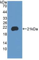 Polyclonal Antibody to Bromodomain Containing Protein 8 (BRD8)