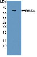 Polyclonal Antibody to Ubiquitin Specific Peptidase 7 (USP7)