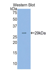 Polyclonal Antibody to Adenosine Kinase (ADK)