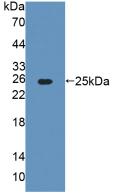 Polyclonal Antibody to Alanine Glyoxylate Aminotransferase (AGXT)