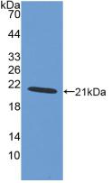 Polyclonal Antibody to Ionized Calcium-binding Adapter Molecule 1 (IBA1)