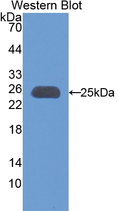 Polyclonal Antibody to Apolipoprotein M (APOM)