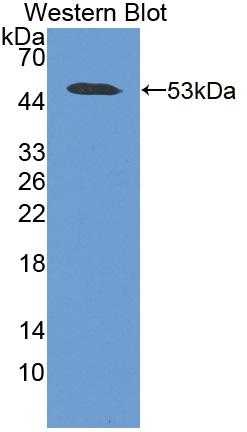 Polyclonal Antibody to Antithrombin (AT)