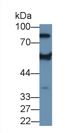 Polyclonal Antibody to Antithrombin (AT)