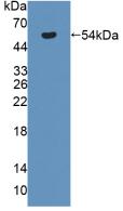 Polyclonal Antibody to Antithrombin (AT)