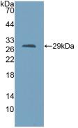 Polyclonal Antibody to Aspartylglucosaminidase (AGA)