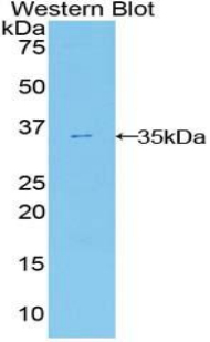 Polyclonal Antibody to Ectonucleotide Pyrophosphatase/Phosphodiesterase 2 (ENPP2)