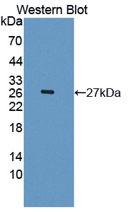 Polyclonal Antibody to Ectonucleotide Pyrophosphatase/Phosphodiesterase 2 (ENPP2)