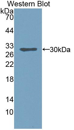 Polyclonal Antibody to B-Cell CLL/Lymphoma 10 (Bcl10)