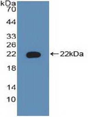 Polyclonal Antibody to Bcl2 Associated Death Promoter (BAD)