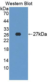 Polyclonal Antibody to C-Src Tyrosine Kinase (CSK)