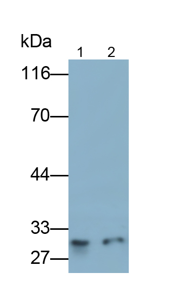 Polyclonal Antibody to Calcyclin Binding Protein (CACYBP)