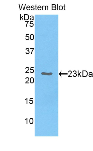 Polyclonal Antibody to Chromobox Homolog 3 (CBX3)